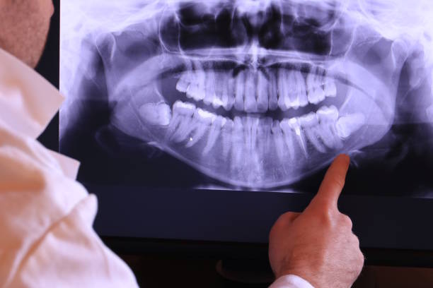 Best Emergency Dental Care for Abscessed Tooth in Bushnell, IL