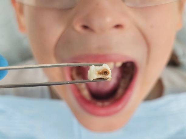 Best Urgent Dental Care for Toothache in Bushnell, IL
